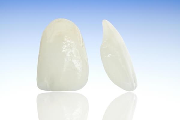  Sứ E.max - IPS E.max