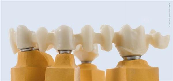 Răng sứ Ceramill Zi